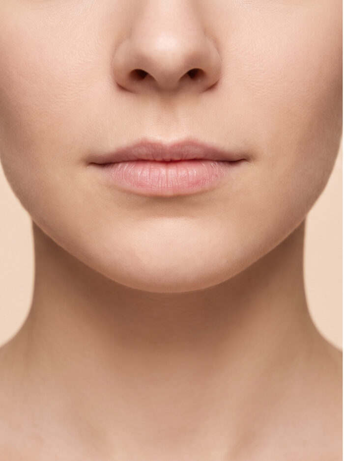 Before Lip Enhancement