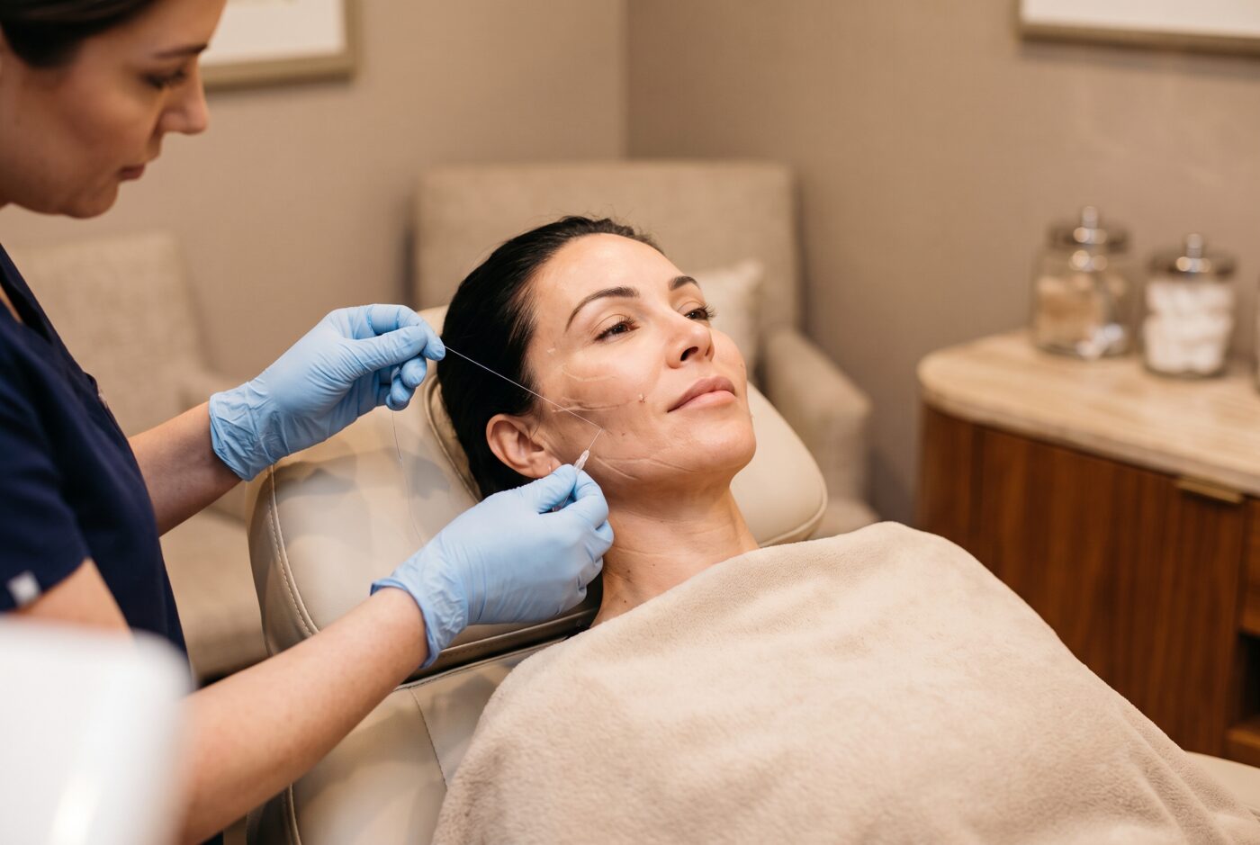 Thread lift treatment